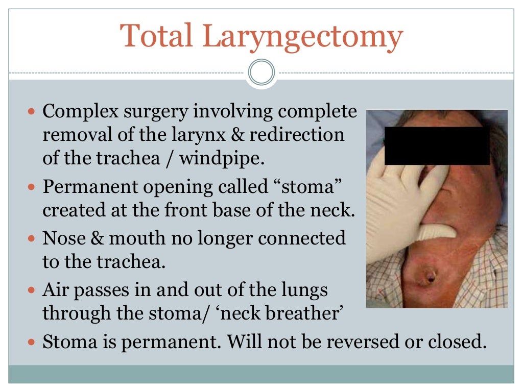 The laryngectomy patient