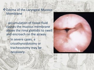 Edema of the Laryngeal Mucous Membrane - accumulation of tissue fluid causes the mucous membrane above the rima glottidis to swell and encroach on the airway.  In severe cases, a cricothyroidotomy or tracheostomy may be necessary. 