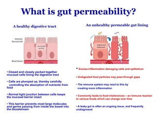 What is gut permeability?
A healthy digestive tract
• Closed and closely packed together
mucosal cells lining the digestive tract
• Cells are plumped up, thereby carefully
controlling the absorption of nutrients from
food
• Normal tight junction between cells keeps
the mucosal barrier intact
• This barrier prevents most large molecules
and germs passing from inside the bowel into
the bloodstream
An unhealthy permeable gut lining
• Excess inflammation damaging cells and epithelium
• Undigested food particles may pass through gaps
• The immune system may react to this by
creating more inflammation
• Commonly leads to food intolerances – an immune reaction
to various foods which can change over time
• A leaky gut is often an ongoing issue, and frequently
undiagnosed
 