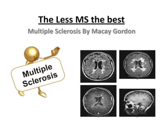 The Less MS the best
Multiple Sclerosis By Macay Gordon
 