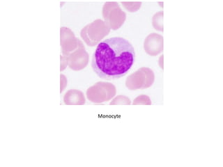 Monocyte
 
