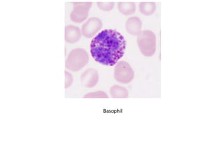 Basophil
 
