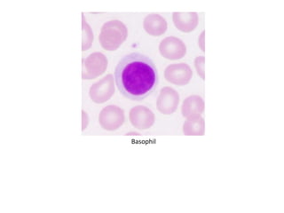 Basophil
 