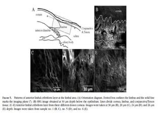 Limbus Tissue The limbus | PPTX