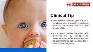 The Literature Review on Cataract Management in Children - Phdassistance