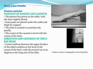 the lower limb positioning | PPTX