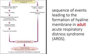Respiratory Distress Syndrome (HYALINE MEMBRANE DISEASE) | PPT