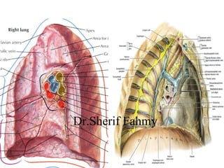 The Lungs (Anatomy of the Thorax) | PPS