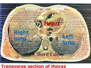 Transverse section of thorax
Heart
Right
lung Left
lung
Dr.Sherif Fahmy
 