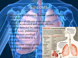 SilicosisSilicosis is a respiratory disease caused by inhaling silica dust.Three types of silicosis exist; simple chronic, accelerated and acute silicosis. It can be detected by eithera chest x-ray, pulmonary function tests purified protein derivative or a skin test. The outcome varies on theamount of damage to the lungs.