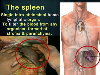 The spleen
Single intra abdominal hemo
lymphatic organ.
To filter the blood from any
organism formed of
stroma & parenchyma.

 
