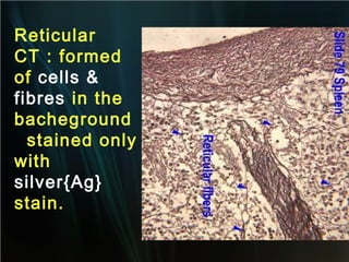 Reticular
CT : formed
of cells &
fibres in the
bacheground
stained only
with
silver{Ag}
stain.

 
