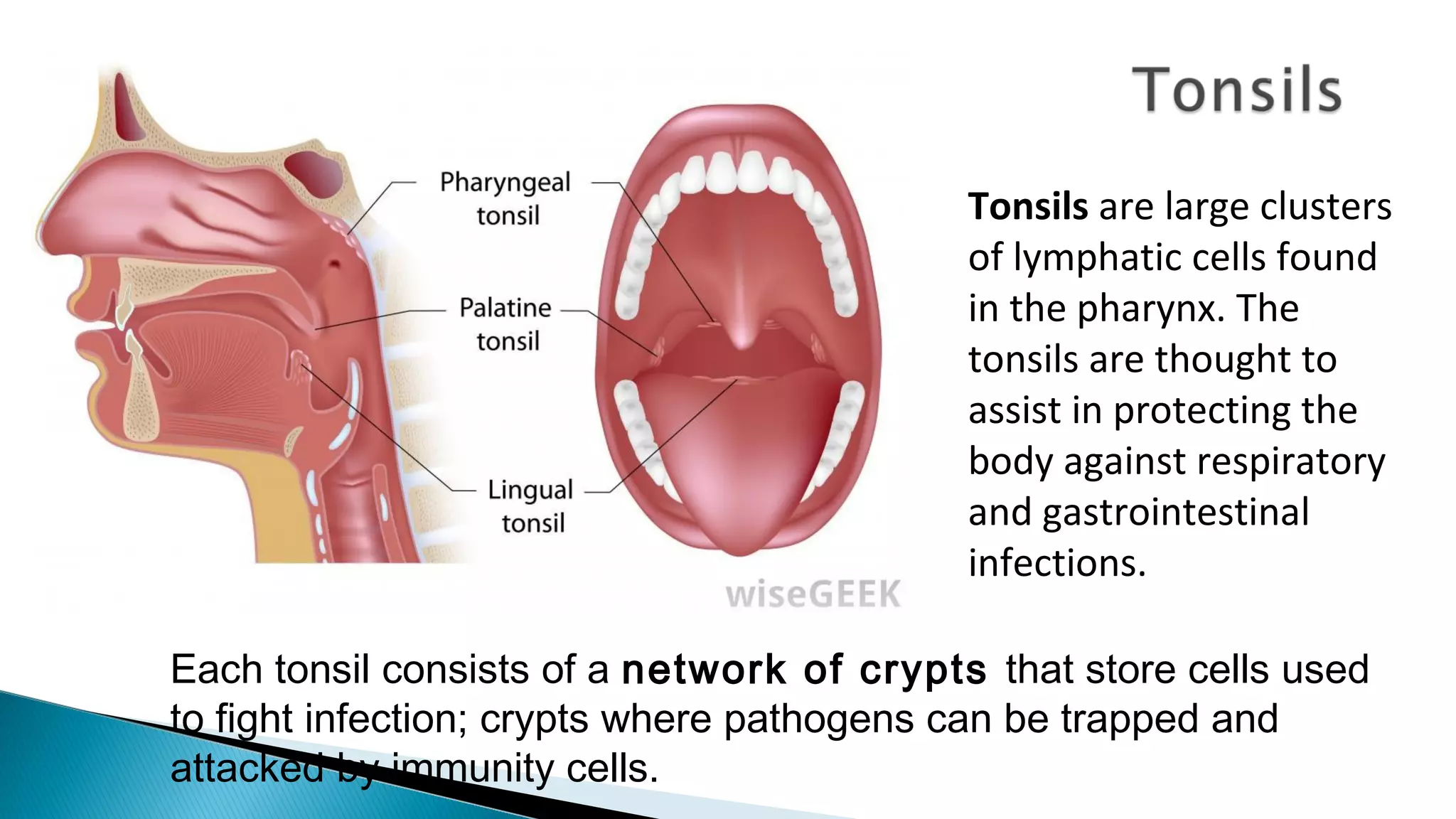 Each tonsil consists of a network of crypts that store cells used
to fight infection; crypts where pathogens can be trapped and
attacked by immunity cells.
Tonsils are large clusters
of lymphatic cells found
in the pharynx. The
tonsils are thought to
assist in protecting the
body against respiratory
and gastrointestinal
infections.
 