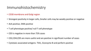 Immunohistochemistry
• CD30 membrane and Golgi region
• Strongest positivity in larger cells, Smaller cells may be weakly positive or negative
• ALK positive, EMA positive
• T cell phenotype positive/ null T cell phenotype
• CD3 is negative in more than 75% cases
• CD2,CD4,CD5 are more useful and are positive in significant number of cases
• Cytotoxic associated antigens- TIA1, Granzyme B and perforin positive
 