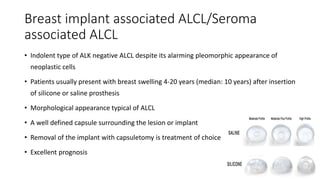 Breast implant associated ALCL/Seroma
associated ALCL
• Indolent type of ALK negative ALCL despite its alarming pleomorphic appearance of
neoplastic cells
• Patients usually present with breast swelling 4-20 years (median: 10 years) after insertion
of silicone or saline prosthesis
• Morphological appearance typical of ALCL
• A well defined capsule surrounding the lesion or implant
• Removal of the implant with capsuletomy is treatment of choice
• Excellent prognosis
 