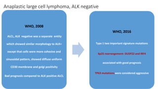 Anaplastic large cell lymphoma, ALK negative
WHO, 2008
ALCL, ALK negative was a separate entity
which showed similar morphology to ALK+
except that cells were more cohesive and
sinusoidal pattern, showed diffuse uniform
CD30 membrane and golgi positivity
Bad prognosis compared to ALK positive ALCL
WHO, 2016
Type 1 two important signature mutations
6p25 rearrangement- DUSP22 and IRF4
associated with good prognosis
TP63 mutations were considered aggressive
 