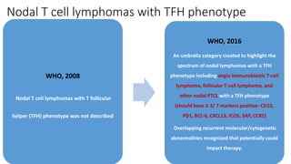 Nodal T cell lymphomas with TFH phenotype
WHO, 2008
Nodal T cell lymphomas with T follicular
helper (TFH) phenotype was not described
WHO, 2016
An umbrella category created to highlight the
spectrum of nodal lymphomas with a TFH
phenotype including angio immunoblastic T-cell
lymphoma, follicular T-cell lymphoma, and
other nodal PTCL with a TFH phenotype
(should have 2-3/ 7 markers positive- CD10,
PD1, BCL-6, CXCL13, ICOS, SAP, CCR5)
Overlapping recurrent molecular/cytogenetic
abnormalities recognized that potentially could
impact therapy.
 