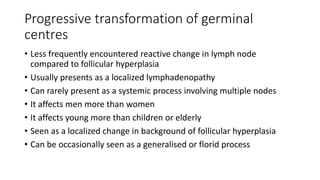 Progressive transformation of germinal
centres
• Less frequently encountered reactive change in lymph node
compared to follicular hyperplasia
• Usually presents as a localized lymphadenopathy
• Can rarely present as a systemic process involving multiple nodes
• It affects men more than women
• It affects young more than children or elderly
• Seen as a localized change in background of follicular hyperplasia
• Can be occasionally seen as a generalised or florid process
 