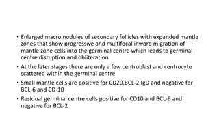 • Enlarged macro nodules of secondary follicles with expanded mantle
zones that show progressive and multifocal inward migration of
mantle zone cells into the germinal centre which leads to germinal
centre disruption and obliteration
• At the later stages there are only a few centroblast and centrocyte
scattered within the germinal centre
• Small mantle cells are positive for CD20,BCL-2,IgD and negative for
BCL-6 and CD-10
• Residual germinal centre cells positive for CD10 and BCL-6 and
negative for BCL-2
 