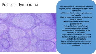 Follicular lymphoma Even distribution of closely packed enlarged
uniform follicles that completely efface nodal
architecture
Follicles are distributed throughout cortex
and medulla
Slight or moderate variation in the size and
shape of follicles
Massive infiltration of capsule and
pericapsular fat
Fading of follicles( lack of sharply
demarcated germinal centres)
Condensation of reticulin fibres at the
periphery of the follicles
Tingible body macrophages are absent
Random distribution of centrocyte and
centroblast within follicles
Sparse follicular dendritic cell meshwork
Diffuse areas may be seen- composed of
centroblast
 