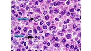 centroblast
centrocyte
 