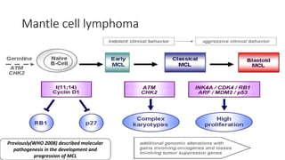 Mantle cell lymphoma
Previously(WHO 2008) described molecular
pathogenesis in the development and
progression of MCL
 