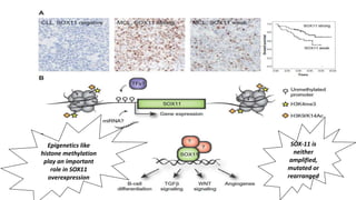 Epigenetics like
histone methylation
play an important
role in SOX11
overexpression
SOX-11 is
neither
amplified,
mutated or
rearranged
 