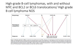 High-grade B-cell lymphomas, with and without
MYC and BCL2 or BCL6 translocations/ High grade
B cell lymphoma NOS
 