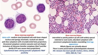 Bone marrow aspirate
Hairy cells- medium sized lymphoid cells with bean shaped
nucleus and spongy chromatin, nucleoli are absent
pale blue cytoplasm with circumferential hairy projections.
Occasional cytoplasm contains vacoules and rod shaped
inclusions of ribosome lamellar complexes (Gas7 and Rho
family GTP ases causes hairy projections)
Cytochemical stain: strong granular cytoplasmic TRAP
positivity
Bone marrow biopsy
Interstitial or patchy pattern of cells with widely spaced
indented or oval nuclei, abundant cytoplasm with
prominent cytoplasmic borders resembling fried egg
appearance
Mitotic figures are virtually absent
There is some preservation of hematopoietic elements
IHC: Annexin A1( most specific marker), CD11c, CD103,
CD25, DBA.44, T-bet
 