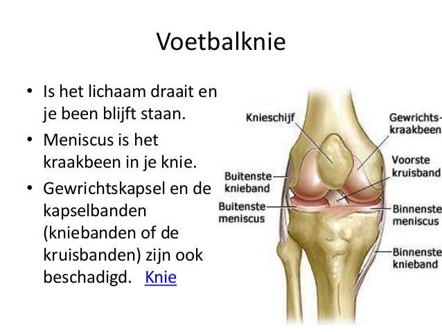 vocht in knie door overbelasting