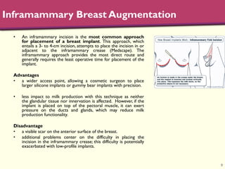 Inframmary Ridge Location The main breast_augmentation_techniques_in_2017 | PDF