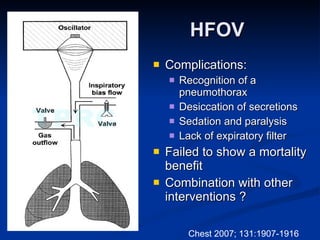 The management of acute respiratory distress syndrome | PPT