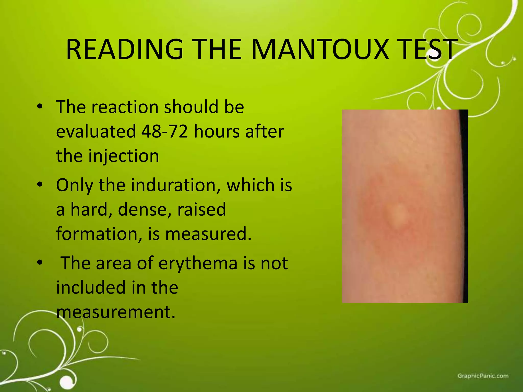 READING THE MANTOUX TEST 
• The reaction should be 
evaluated 48-72 hours after 
the injection 
• Only the induration, which is 
a hard, dense, raised 
formation, is measured. 
• The area of erythema is not 
included in the 
measurement. 
 