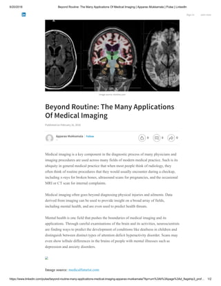 6/20/2018 Beyond Routine: The Many Applications Of Medical Imaging | Apparao Mukkamala | Pulse | LinkedIn
https://www.linkedin.com/pulse/beyond-routine-many-applications-medical-imaging-apparao-mukkamala/?lipi=urn%3Ali%3Apage%3Ad_flagship3_prof… 1/2
Image source: itonline.com
Beyond Routine: The Many Applications
Of Medical Imaging
Published on February 16, 2018
Medical imaging is a key component in the diagnostic process of many physicians and
imaging procedures are used across many fields of modern medical practice. Such is its
ubiquity in general medical practice that when most people think of radiology, they
often think of routine procedures that they would usually encounter during a checkup,
including x-rays for broken bones, ultrasound scans for pregnancies, and the occasional
MRI or CT scan for internal complaints.
Medical imaging often goes beyond diagnosing physical injuries and ailments. Data
derived from imaging can be used to provide insight on a broad array of fields,
including mental health, and are even used to predict health threats.
Mental health is one field that pushes the boundaries of medical imaging and its
applications. Through careful examinations of the brain and its activities, neuroscientists
are finding ways to predict the development of conditions like deafness in children and
distinguish between distinct types of attention deficit hyperactivity disorder. Scans may
even show telltale differences in the brains of people with mental illnesses such as
depression and anxiety disorders.
Image source: medicalfuturist.com
Apparao Mukkamala
--
Follow
Sign in Join now
0 0 0
 