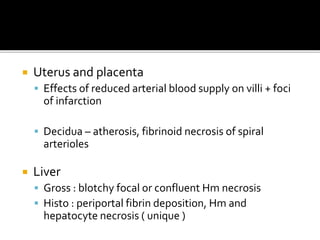  Uterus and placenta
 Effects of reduced arterial blood supply on villi + foci
of infarction
 Decidua – atherosis, fibrinoid necrosis of spiral
arterioles
 Liver
 Gross : blotchy focal or confluent Hm necrosis
 Histo : periportal fibrin deposition, Hm and
hepatocyte necrosis ( unique )
 