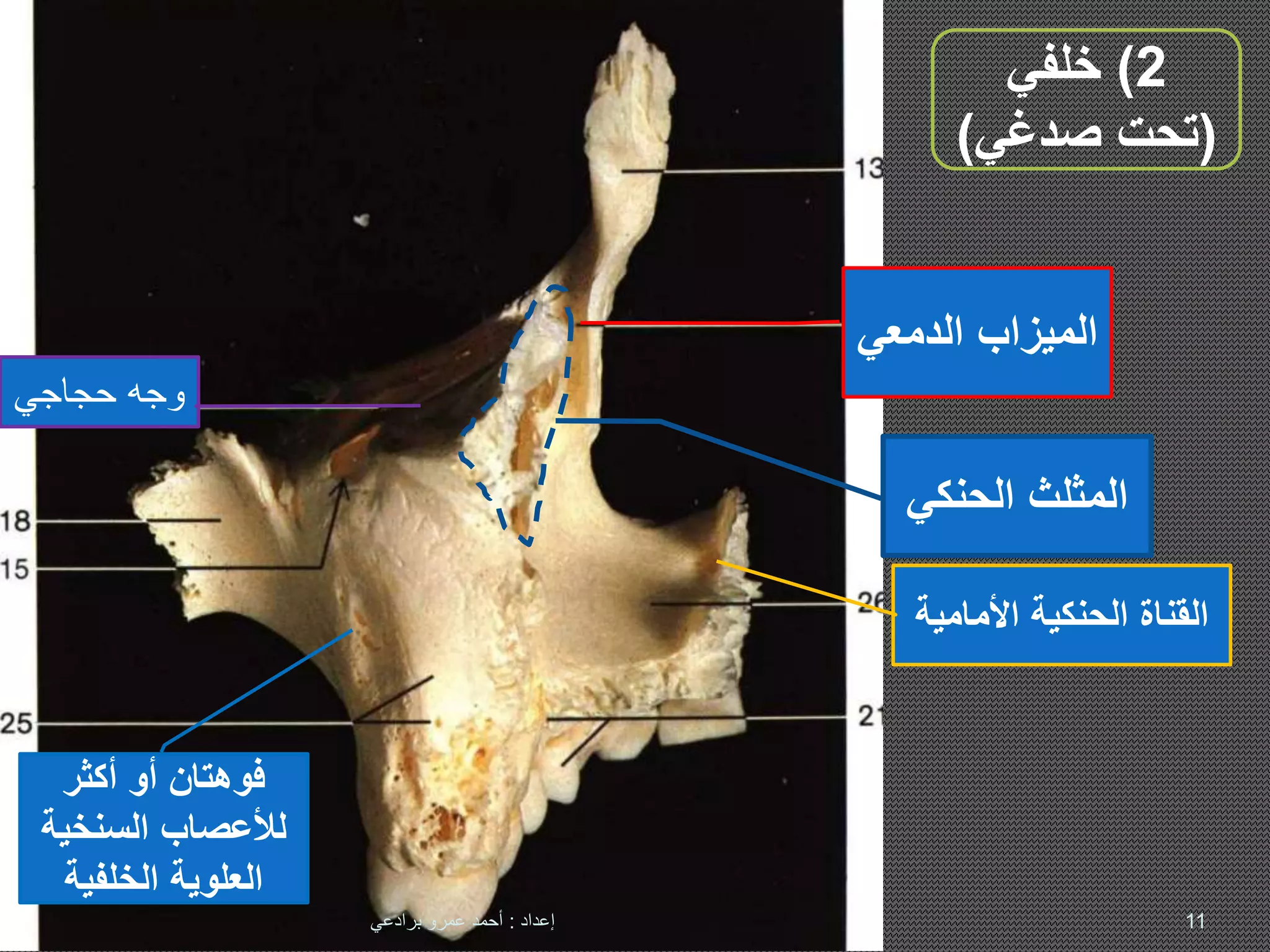 The Maxilla - Anatomy تشريح عظم الفك العلوي | PPTX
