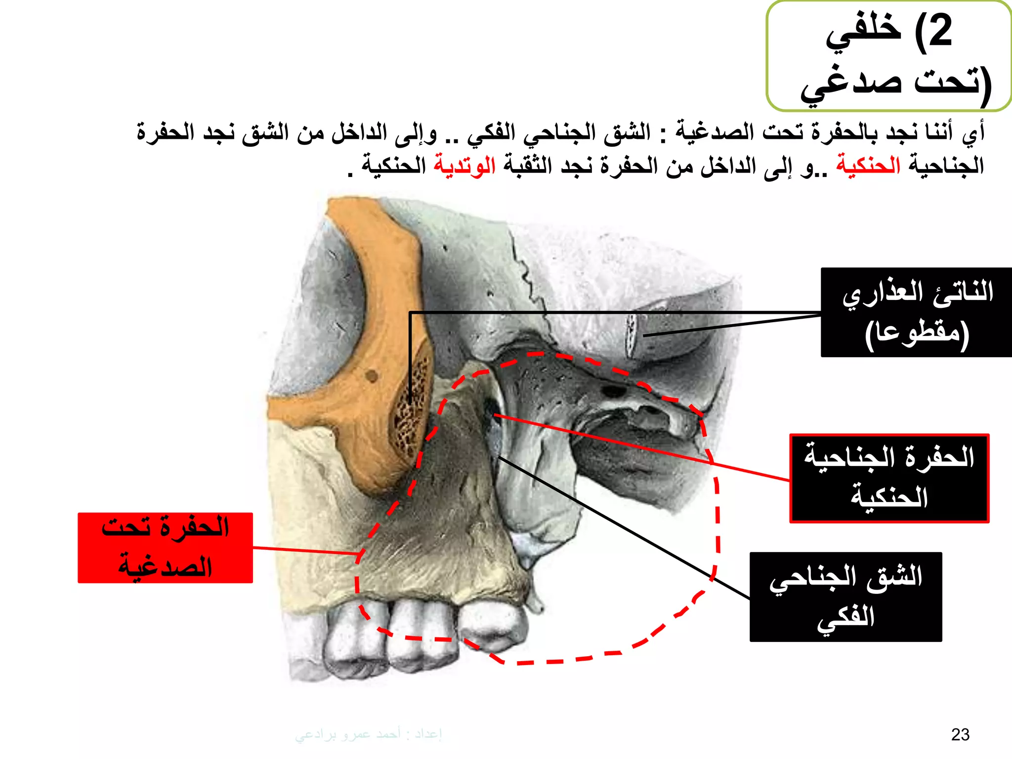 The Maxilla - Anatomy تشريح عظم الفك العلوي | PPTX