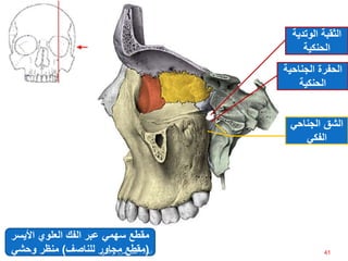 ‫األي‬ ‫العلوي‬ ‫الفك‬ ‫عبر‬ ‫سهمي‬ ‫مقطع‬‫سر‬
(‫للناصف‬ ‫مجاور‬ ‫مقطع‬)‫وحشي‬ ‫منظر‬
‫الثقبة‬‫الوتدي‬‫ة‬
‫الحنكية‬
‫الجناحي‬ ‫الحفرة‬‫ة‬
‫الحنكية‬
‫الجناحي‬ ‫الشق‬
‫الفكي‬
41‫إعداد‬:‫برادعي‬ ‫عمرو‬ ‫أحمد‬
 