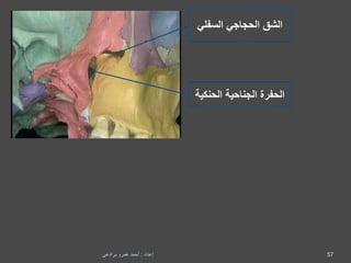 ‫الشق‬‫الحجاجي‬‫السفلي‬
‫الحنك‬ ‫الجناحية‬ ‫الحفرة‬‫ية‬
57‫إعداد‬:‫برادعي‬ ‫عمرو‬ ‫أحمد‬
 