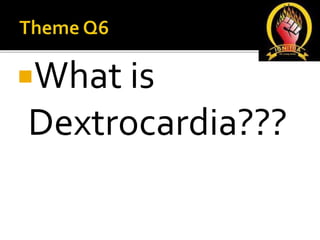 What is
Dextrocardia???
 