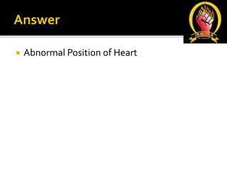  Abnormal Position of Heart
 