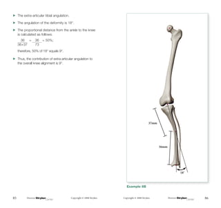 Tibia Angulation The Measurement and Analysis of Axial Deformity at The Knee.pdf