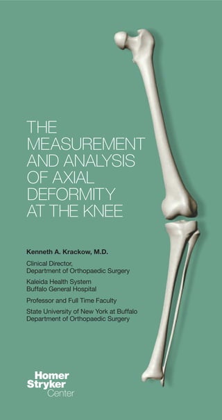 Kenneth A. Krackow, M.D.
Clinical Director,
Department of Orthopaedic Surgery
Kaleida Health System
Buffalo General Hospital
Professor and Full Time Faculty
State University of New York at Buffalo
Department of Orthopaedic Surgery
THE
MEASUREMENT
AND ANALYSIS
OF AXIAL
DEFORMITY
AT THE KNEE
 