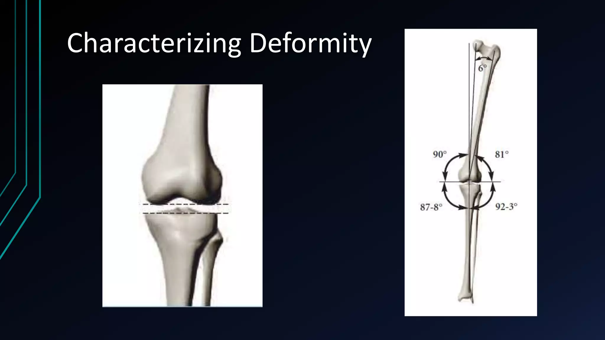 The Measurement and Analysis of Axial Deformity at The Knee.pptx