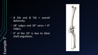 Tibia Anguation The Measurement and Analysis of Axial Deformity at The Knee.pptx