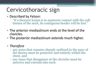 Cervicothoracic sign
• Described by Felson:
▫ “If a thoracic lesion is in anatomic contact with the soft
tissues of the neck, its contiguous border will be lost.”
• The anterior mediastinum ends at the level of the
clavicles.
• The posterior mediastinum extends much higher.
• Therefore
▫ any mass that remains sharply outlined in the apex of
the thorax must be posterior and entirely within the
chest, and
▫ any mass that disappears at the clavicles must be
anterior and extends into neck
 