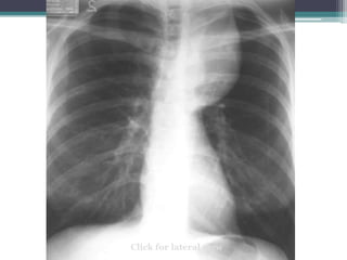 Click for lateral view
 