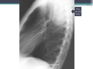 Click for answer
This
should
help!
 