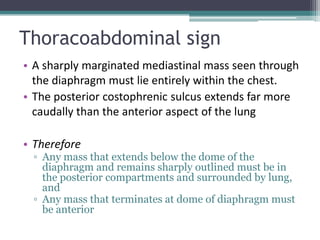 Thoracoabdominal sign
• A sharply marginated mediastinal mass seen through
the diaphragm must lie entirely within the chest.
• The posterior costophrenic sulcus extends far more
caudally than the anterior aspect of the lung
• Therefore
▫ Any mass that extends below the dome of the
diaphragm and remains sharply outlined must be in
the posterior compartments and surrounded by lung,
and
▫ Any mass that terminates at dome of diaphragm must
be anterior
 
