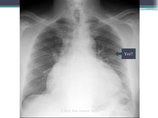 Yes!!
Click for more info
 